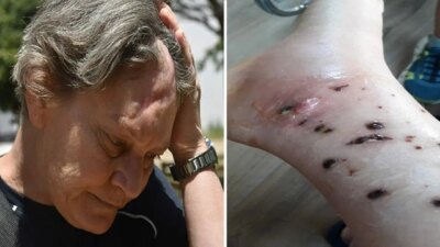 ‘Eğitimim yok’ demesine karşın köpek bakımında çalıştırıldı, taarruza uğradı: ‘Şirket sahibinin hesap vermesini istiyorum’