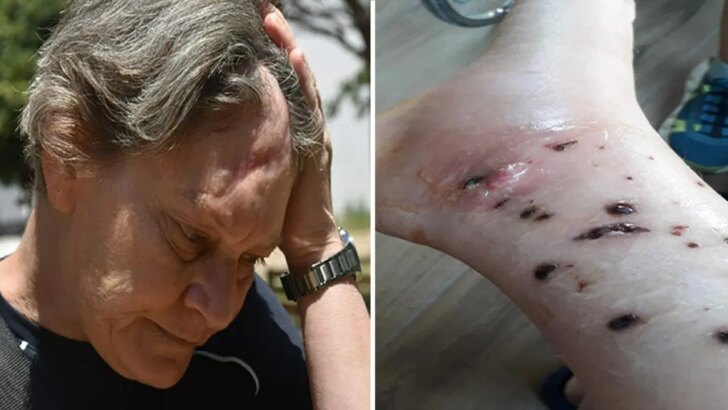 ‘Eğitimim yok’ demesine karşın köpek bakımında çalıştırıldı, taarruza uğradı: ‘Şirket sahibinin hesap vermesini istiyorum’
